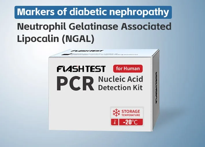 Neutrophil Gelatinase Associated Lipocalin (NGAL)