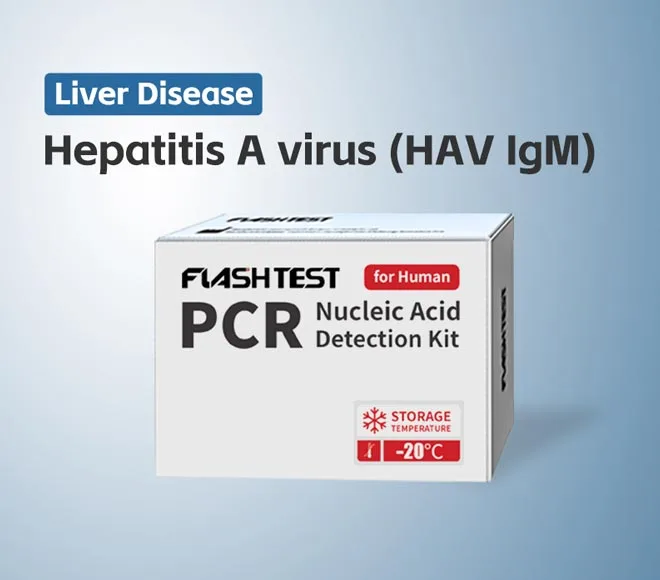 hepatitis a virus hav igm