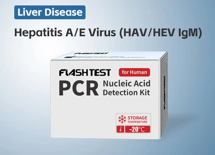 Hepatitis A/E Virus (HAV/HEV IgM)