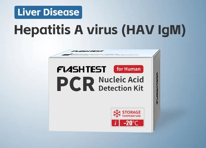 Hepatitis A Virus (HAV IgM)