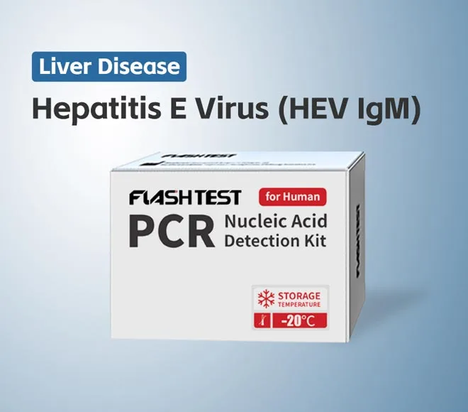 hepatitis e virus hev igm