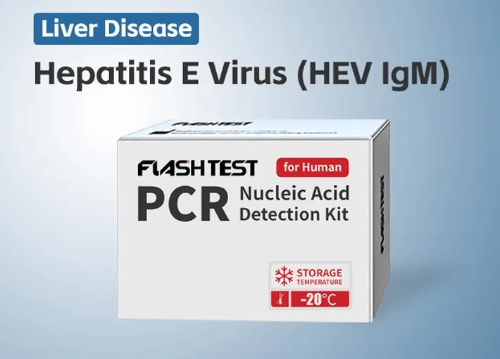 Hepatitis E Virus (HEV IgM)